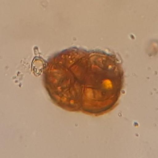 Didymodon rigidulus other