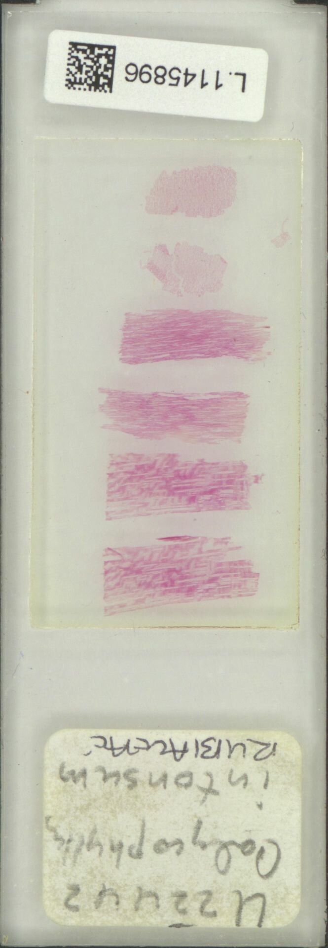 Calycophyllum intonsum — related species from the same genus