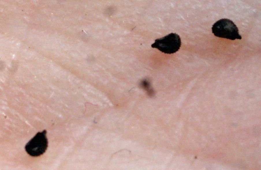 Petrorhagia velutina fruit