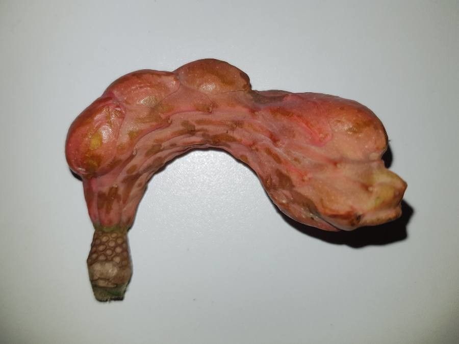 Magnolia × soulangeana fruit