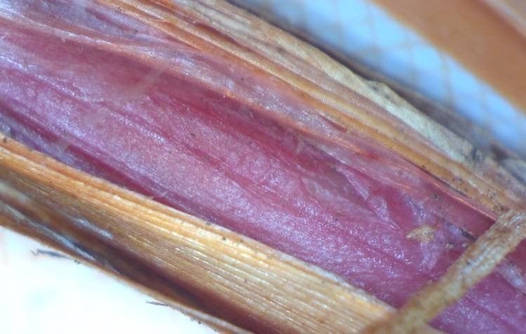 Allium saxatile bark