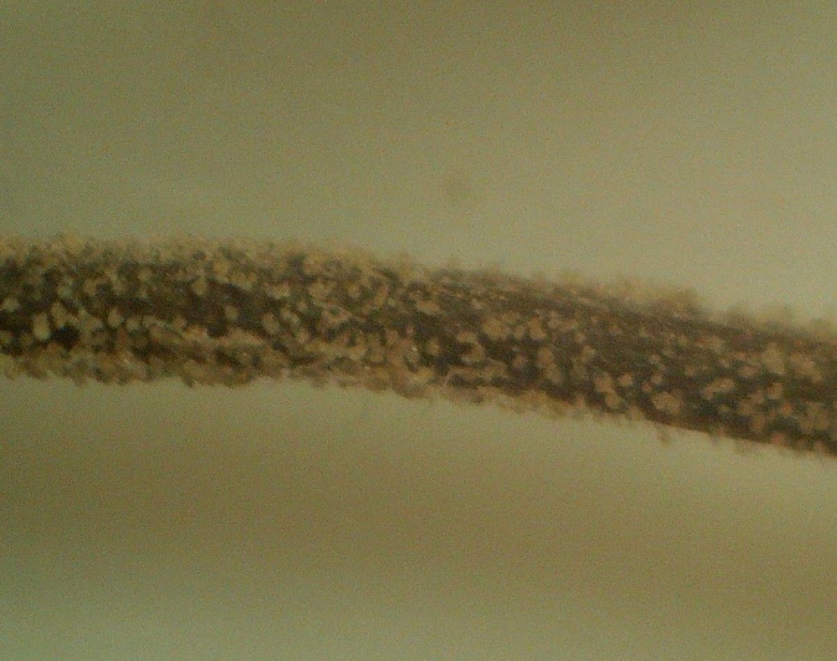 Thalictrum foetidum bark