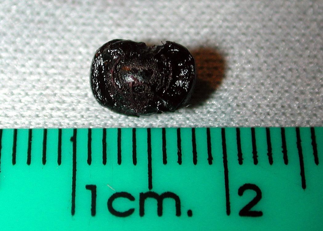 Trichostigma polyandrum other