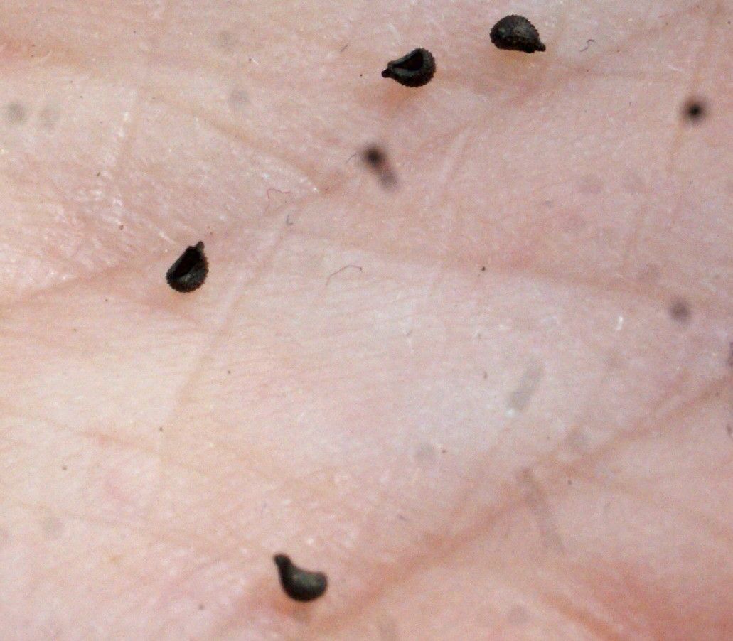 Petrorhagia velutina fruit