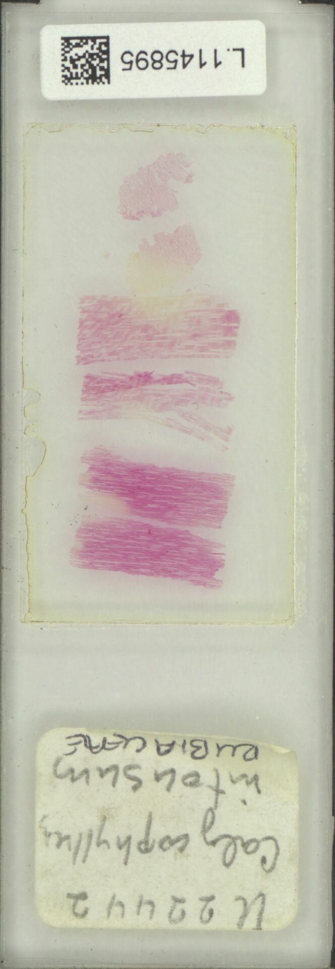 Calycophyllum intonsum fruit